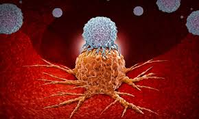 That's why it's important to understand the risk factors and symptoms. Immunotherapy Could Cure Advanced Pancreatic Cancer