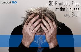 The mucous membrane is thin tissue that lines the nose, sinuses, and throat. 3d Free And Downloadable Printable Files Of The Sinus Anatomy And Skull Best Embodi3d Com Medical And Anatomic Files Embodi3d Com