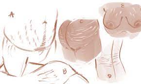 Stretch marks can occur during sudden changes in body size, such as during pregnancy, puberty, or rapid weight gain or loss. Pin On Drawing References