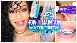 How to whiten with braces. How I Maintain White Teeth With Braces Youtube