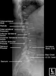Lumbar Spine Lateral View On X Ray Www Anatomynote Com Radiology Imaging Radiology Student Radiology Technologist