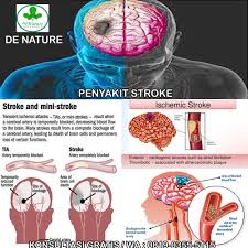 Menghindari alkohol, kafein, dan rokok. Nama Obat Herbal Stroke Sebelah Kiri Obat Stroke Powered By Doodlekit