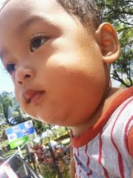 Jaga agar dagu anda ke atas dan leher anda lurus. Cerita Cha Pembengkakan Kelenjar Getah Bening Pada Bayi