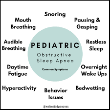 Image result for Obstructive Sleep Apnea