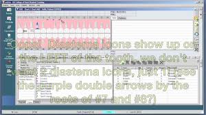 Phase 3 Charting Findings On The Odontogram Youtube