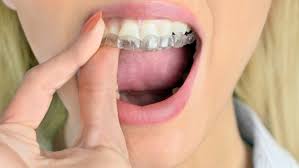 There are also a range of orthodontic treatments which are possible to have which do not have invisible braces. Invisalign Fayetteville Ar Straight Teeth Without Braces