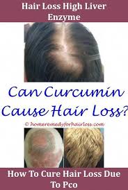 In order to properly cure the acne or the hair. Hormonal Imbalance Acne And Hair Loss Hair Loss Can Diovan Cause Hair Loss Aloe Vera For Hair Hair Loss Men Hair Loss Women Treatment Hair Loss Remedies Women