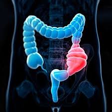 Pastillas homeopaticas para bajar de peso yahoo. Que Es El Dolor Abdominal Definicion Y Hechos Cega