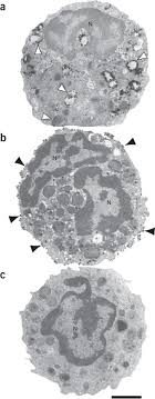 Maybe you would like to learn more about one of these? Pre Embedding Immunogold Labeling To Optimize Protein Localization At Subcellular Compartments And Membrane Microdomains Of Leukocytes Nature Protocols