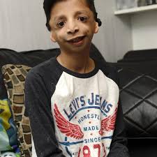 Boy gets chance at normal life thanks to free operation to treat rare ear  disease seen in 'Wonder'