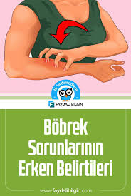 Bobrek Sorunlarinin Erken Belirtileri Saglik Bobrek Yetmezligi Saglik Recete