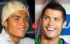 Cristiano ronaldo was angry because they put coca cola in front of him at the portugal press conference, instead of water! Pin On Celebrity Teeth