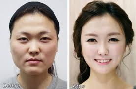 What experience is needed for a plastic surgeon? South Korean Plastic Surgery So Good People Need Certificates To Prove Who They Are Daily Mail Online
