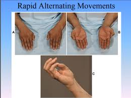 Image result for Rapid Alternating Movements