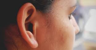 Smell Behind Ears Causes Symptoms And Treatments Irritated Skin Ear Smell Good