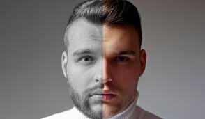 Related content you might like. Beard Transplants Benefits Cost Results Are They For You Beardoholic