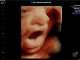Check spelling or type a new query. A Gallery Of High Resolution Ultrasound Color Doppler 3d Images 3d Fetal Images