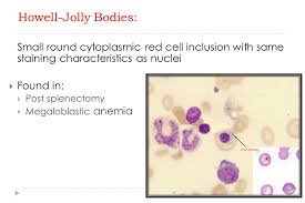 Practical Of Clinical Hematology Ppt Video Online Download