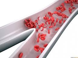 Sickle cell disease is a genetic disorder caused by mutations in the beta globin gene that leads to faulty hemoglobin protein, called hemoglobin s. Forscher Unternehmen Schritt In Richtung Zur Gentherapie Fur Sichelzellenanamie United States