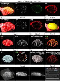 Metal fillings are typically not made of ferrous metals, meaning containing iron. Longitudinal In Vivo Imaging And Quantification Of Human Pancreatic Islet Grafting And Contributing Host Cells In The Anterior Eye Chamber Protocol