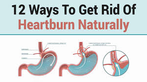 12 Ways To Get Rid Of Heartburn Naturally