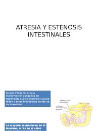 ¿qué es un estenosis aórtica? Atresia Y Estenosis