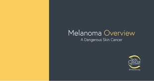 We also explore how it is diagnosed and the many treatment options now available should you be unfort. Melanoma The Skin Cancer Foundation