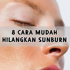 Bagaimana cara menghilangkan kutil yang muncul di tapak kaki, wajah, atau tangan? Maria Firdz Lifestyle Blogger