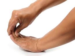 Telapak tangan, khususnya, bisa terasa gatal dalam kasus ini karena histamin cenderung terkumpul dalam jumlah yang lebih banyak di tangan dan kaki. Mengobati Lengan Yang Terkilir Akibat Angkat Beban Berat