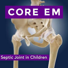 Image result for Septic Joint