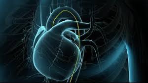 Ils sont peu ou pas soulagés par la nitroglycérine ou l'arrêt de l'activité. Stentul Coronarian Cardiologie Ghid De Boli