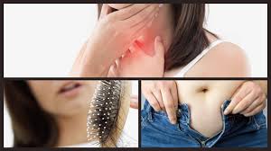 The hair follicle is replaced by scar tissue, so hair loss is permanent. Does Thyroid Cause Hair Loss And Weight Gain Biocity Healthcare