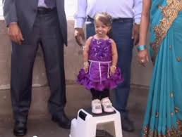 Si la jeune fille est d'une si petite taille, c'est parce qu'elle souffre de la plus grave maladie de nanisme, l'achondroplasia. Je Suis La Femme La Plus Petite Au Monde Et Alors Seneplus