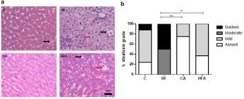 The if diet skinner, robert on amazon.com. Acai Euterpe Oleracea Martius Supplementation In The Diet During Gestation And Lactation Attenuates Liver Steatosis In Dams And Protects Offspring Springerlink