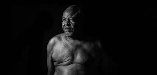 How does breast cancer diagnosis fit into treating cancer? Men With Breast Cancer Fare Better If Diagnosed Earlier Cancer Health