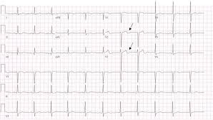 Image result for U Wave