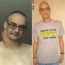 Son's tribute to brave Dad who died from melon-sized tumor