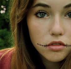 Ask anything you want to learn about chelsea smile by getting answers on askfm. I Survived A Chelsea Smile By Chsswntsjck On Deviantart