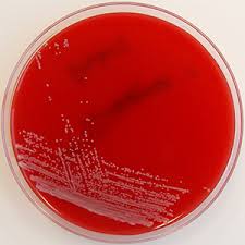 Image result for Corynebacterium