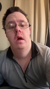 Matt Tolbert Downsyndrome