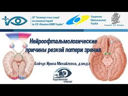 Golovnaya Bol I Pomutnenie Zreniya Glavnye Prichiny Medicinskij Centr Po Ul Leninskaya 14 V G Mozyre