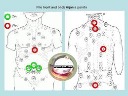 Pile Front And Back Arabic Hijama Points Hijama Hijama Points Cupping Points