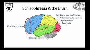 People who have schizophrenia may hear voices or see things that aren't real. Schizophrenia Introduction To Psychology Neuroscience