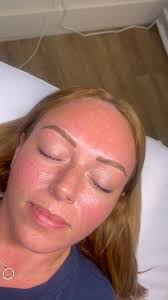 n a n o b r o w s 🔥 *semi-permanent tattoo to mimic the look of hair  strokes *shade is customized to perfectly match hair/brows *lasts 2-3 years  (depending