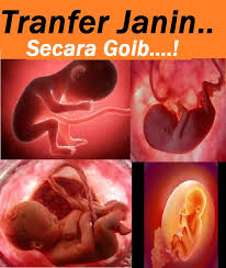 Hasil gambar untuk transfer janin