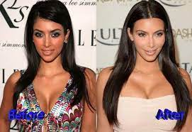 Kim kardashian let's start with kim. Kim Kardashian Before And After Cosmetic Procedure Photoshoptutorialsurreal Kim Kardashian Before Kardashian Plastic Surgery Kim Kardashian Surgery
