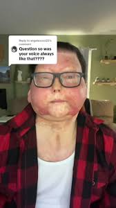 Questions with Joe! Is your voice the same as it was before your accident?  Watch to find out! #QandA #JoeDiMeo #TransplantJourney