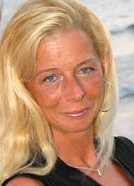 Angkara cinta, wajahnya 'cair'. Nyawa wanita ini selamat kerana implan  payudaranya