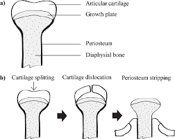 A long bone consists of a long shaft (diaphysis) with two bulky ends or extremities (epiphyses) where articulation takes place. Section Of Long Bone From Broiler Chicken Showing Bone Structure A Download Scientific Diagram