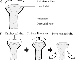 Best way to debone chicken leg quarters. Section Of Long Bone From Broiler Chicken Showing Bone Structure A Download Scientific Diagram